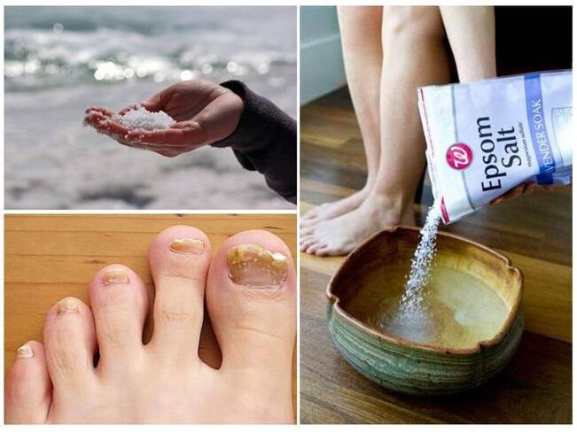 Salt to fight nail fungus